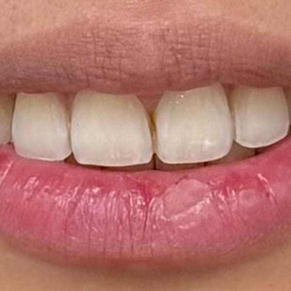 After