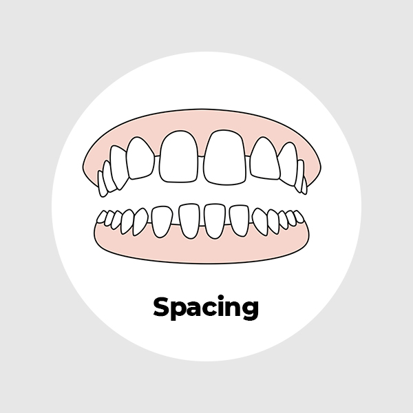 spacing