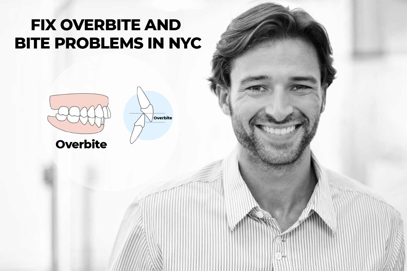 Common teeth problem: Upper Teeth Completely Overlap Lower Teeth