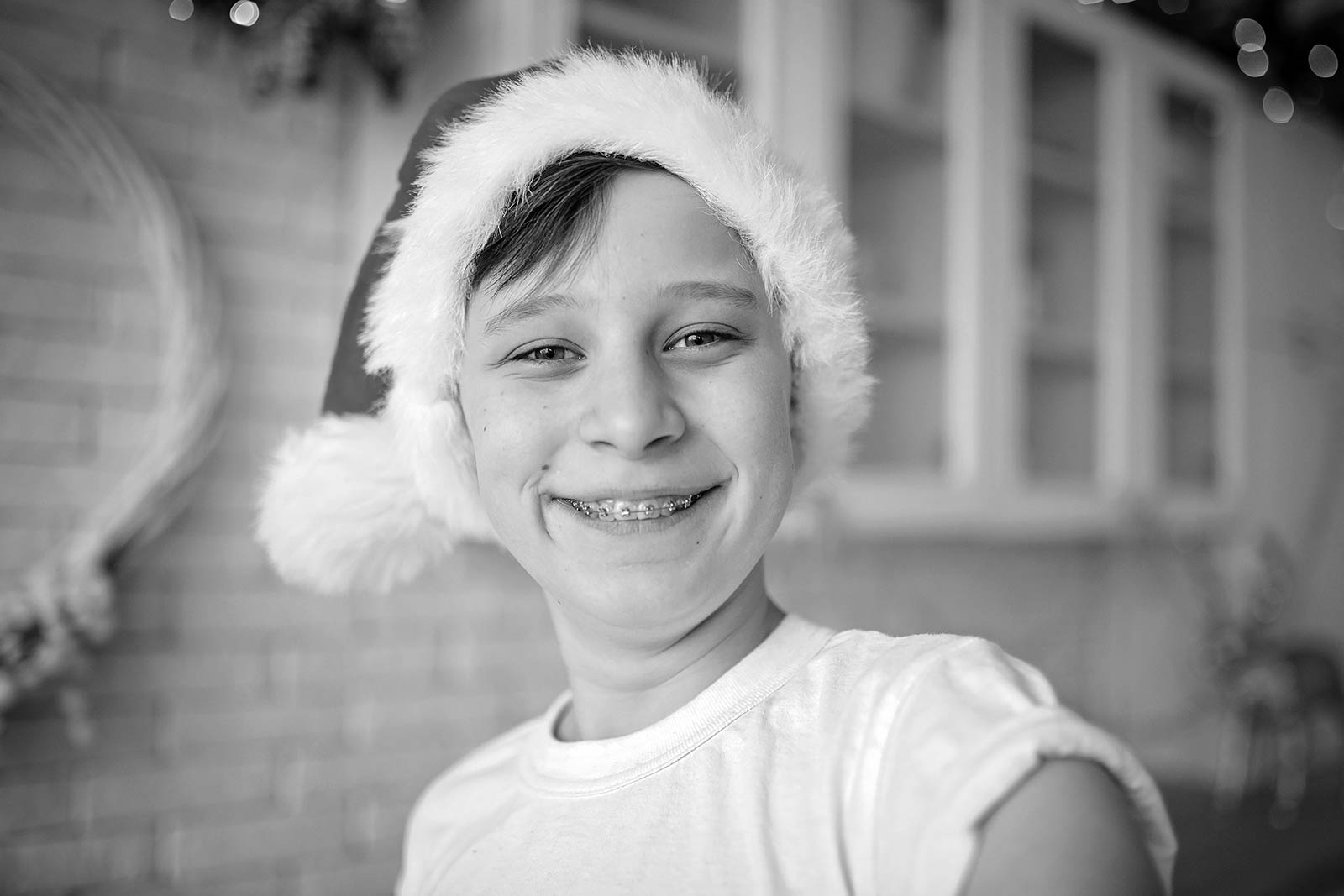 Holiday Foods to Avoid With Braces