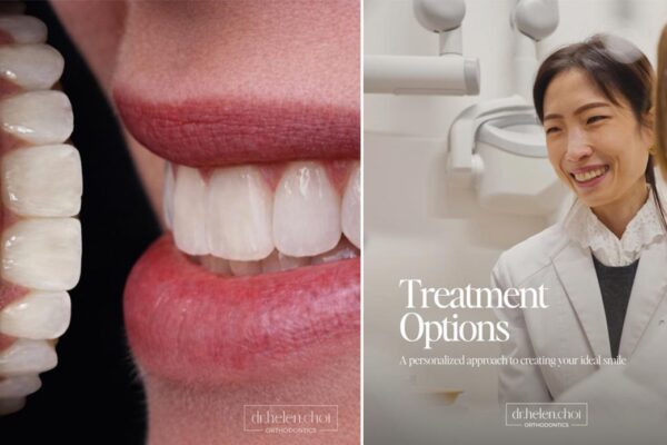 Fix Teeth Gaps, Crooked Teeth, Bite & Jaw Alignment in Manhattan