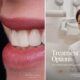 Fix Teeth Gaps, Crooked Teeth, Bite & Jaw Alignment in Manhattan