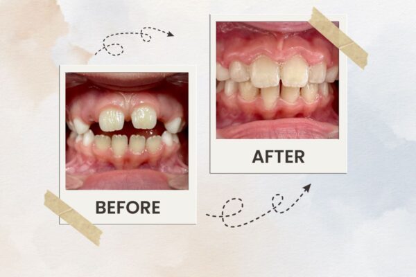 Invisalign & Kids Orthodontist in Manhattan