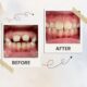Invisalign & Kids Orthodontist in Flatiron Manhattan