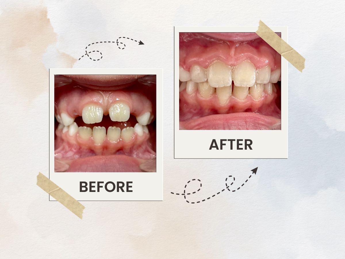 Invisalign & Kids Orthodontist in Flatiron Manhattan