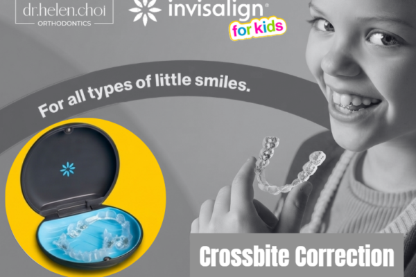 Single-Tooth Crossbite Correction with Invisalign for Kids in the Upper East Side